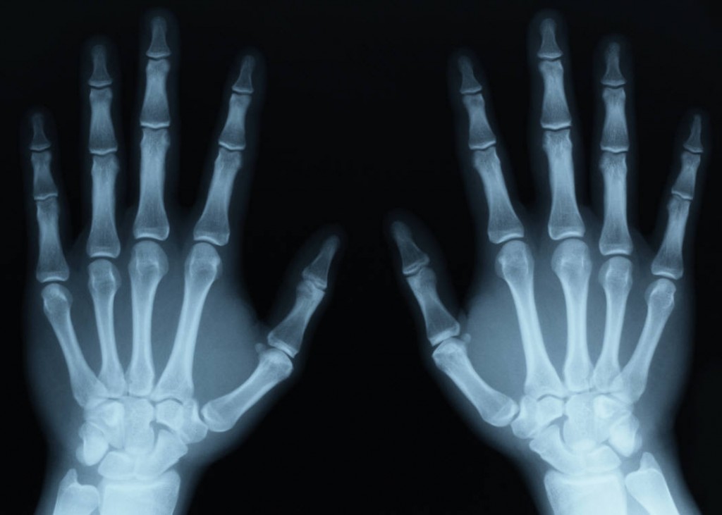 Žmonės – rentgenai: matyti nematomą